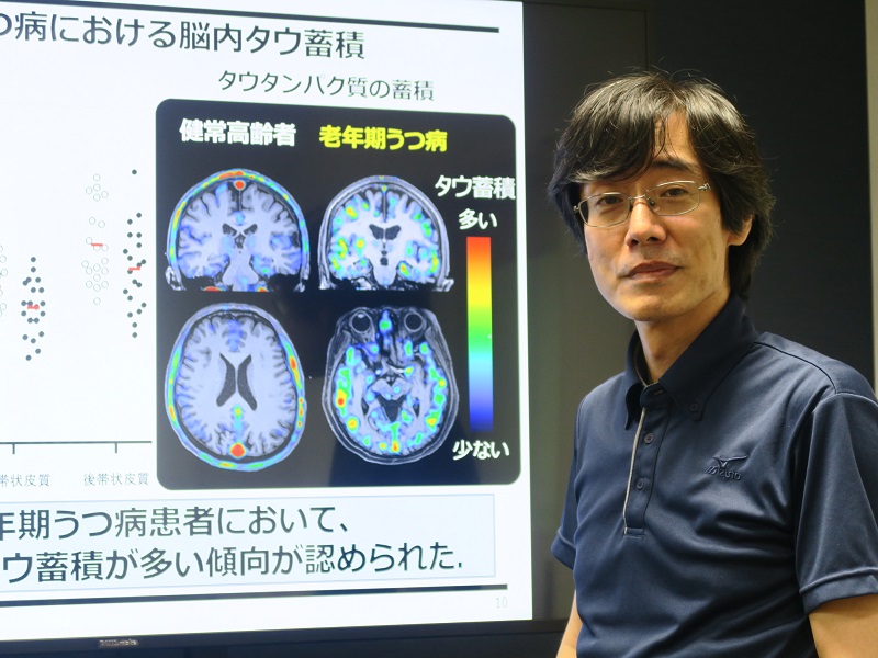 ベッドサイド老年病学 楽天市場】ベッド用 手すり 介助バー サイドサポート オプション