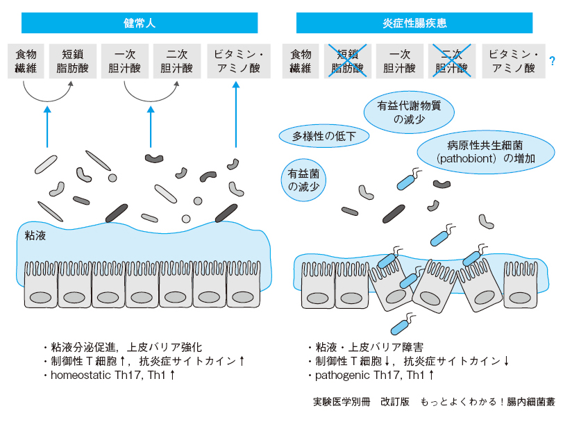 腸内細菌叢のバランス異常（dysbiosis）と疾患【前編】：日経