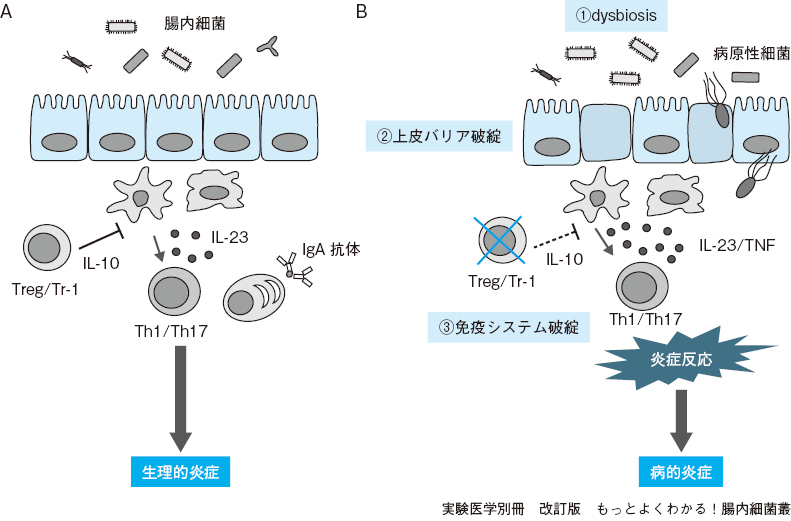 腸内細菌叢のバランス異常（dysbiosis）と疾患【後編】：日経