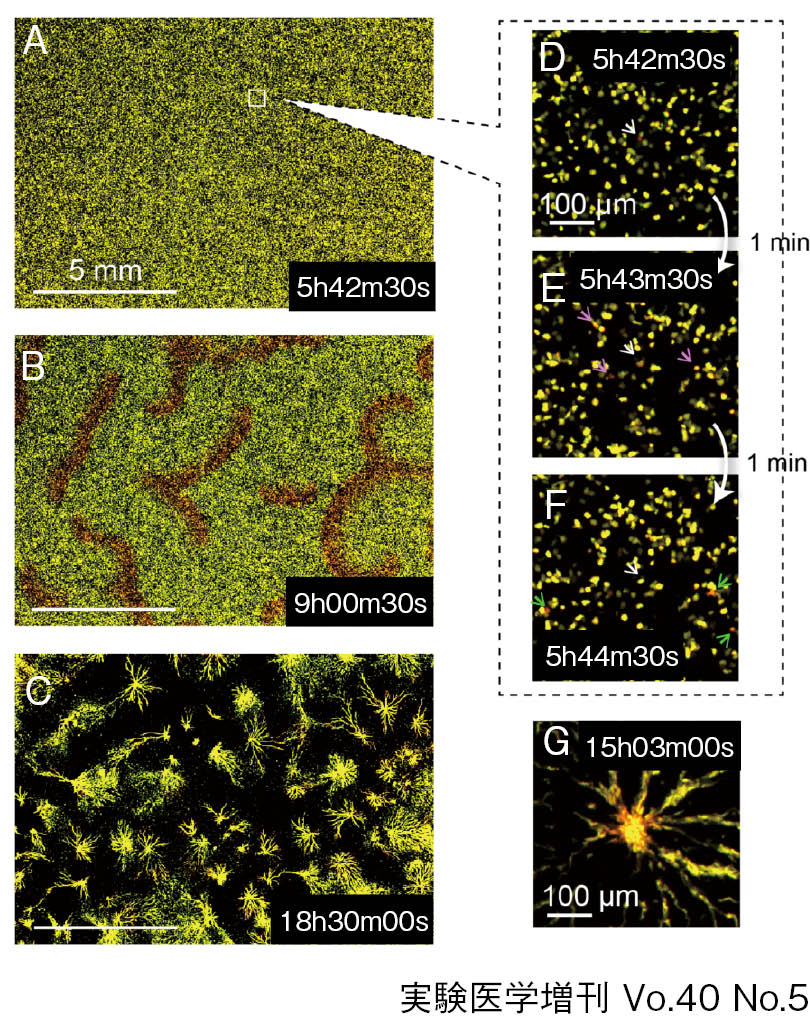 harudesignGL-X 6K2個AMATERAS２個ビームテックアーム4個 Amazon | ORGA 14mmハイダーアタッチメント セット ORGA-HA-01