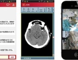 日本初の保険適用の脳血管疾患治療用アプリ「Join」