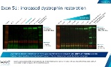 米Wave社、筋ジス向け核酸医薬SuvodirsenのフェーズII/IIIを開始