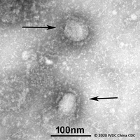 SARS-CoV-2の透過型電子顕微鏡像（提供：IVDC-China CDC via GISAID）