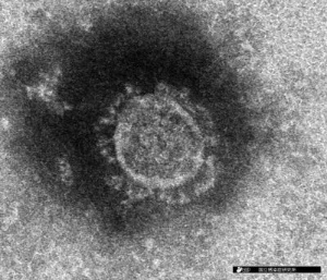 図2 左は新型コロナウイルスの電子顕微鏡像（提供：国立感染症研究所）、右は模式図。ウイルス表面の突起状のS蛋白質が特徴的だ