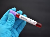 FDA、新型コロナの抗体検査、緊急使用許可した12品目の精度を公表