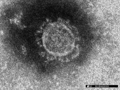 新型コロナウイルスの電子顕微鏡像（提供：国立感染症研究所）