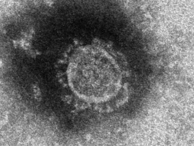 新型コロナウイルスの電顕写真（提供：国立感染症研究所）