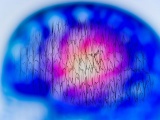 米insitro社、ALSと前頭側頭型認知症の治療薬開発でBMS社と提携
