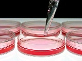 神戸アイセンター、RPE不全症に他家iPS細胞由来RPE細胞の臨床研究開始へ