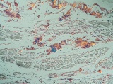 東大が光応答触媒によるAβ除去をマウスで成功、静脈投与が可能になり臨床に一歩前進