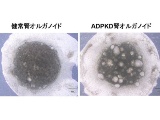 リジェネフロ、最多の単一遺伝子疾患の治療薬開発へiPS細胞を創薬応用