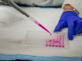 米BMS社、独Evotec社から導入の神経変性疾患治療薬を臨床開発へ