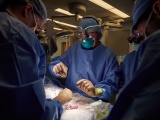 米NYU Langone Health、遺伝子改変ブタの腎臓をヒトに移植、世界初