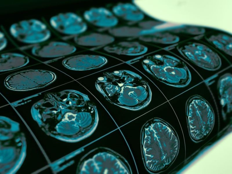 ヴィプチティの副作用